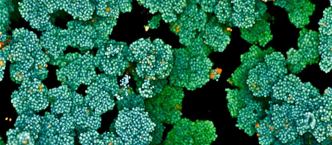 🩹 Une bactérie qui empêche la cicatrisation