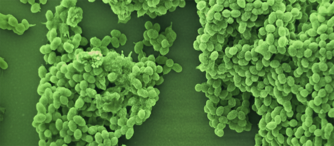 🦠 Contre-intuitif : quand faire taire les bactéries aggrave les infections cardiaques
