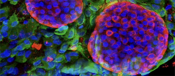 💉 Diabetes: um gel protetor para um futuro sem injeções de insulina