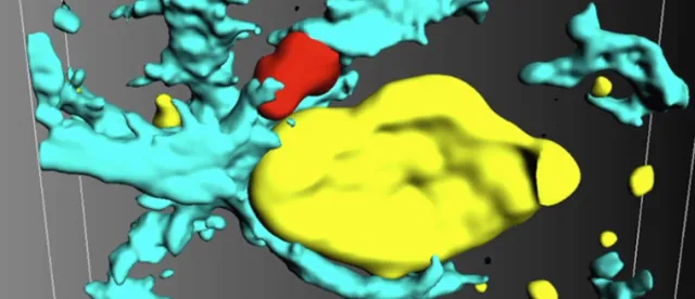 Quand les neurones se retournent contre eux-mêmes