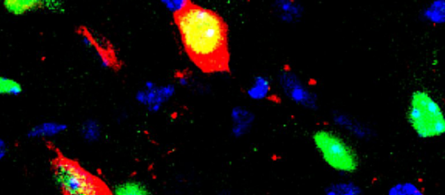 La dopamine, élément clé de l’addiction à l’héroïne