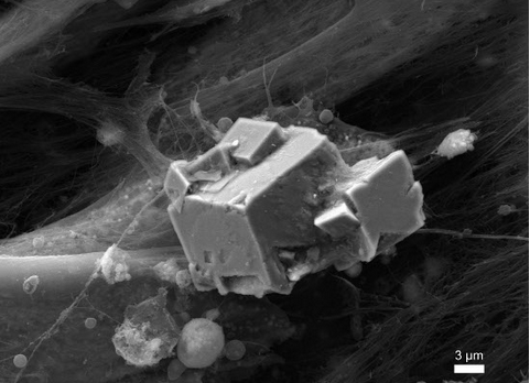 Des « os artificiels » à partir de cellules mères du cordon ombilical