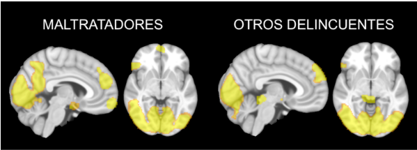 Le cerveau des hommes violents et celui d'autres délinquants fonctionne différemment