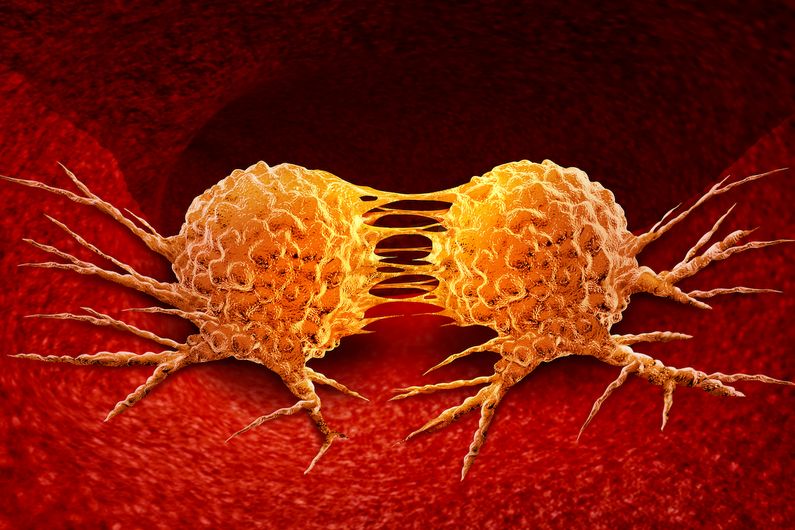 Cancer: mise en lumière d’un mécanisme impliqué dans la formation de métastases
