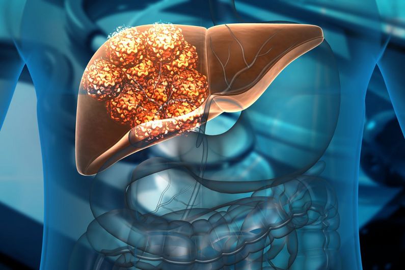 Traiter le cancer du foie avec des microrobots pilotés par un champ magnétique