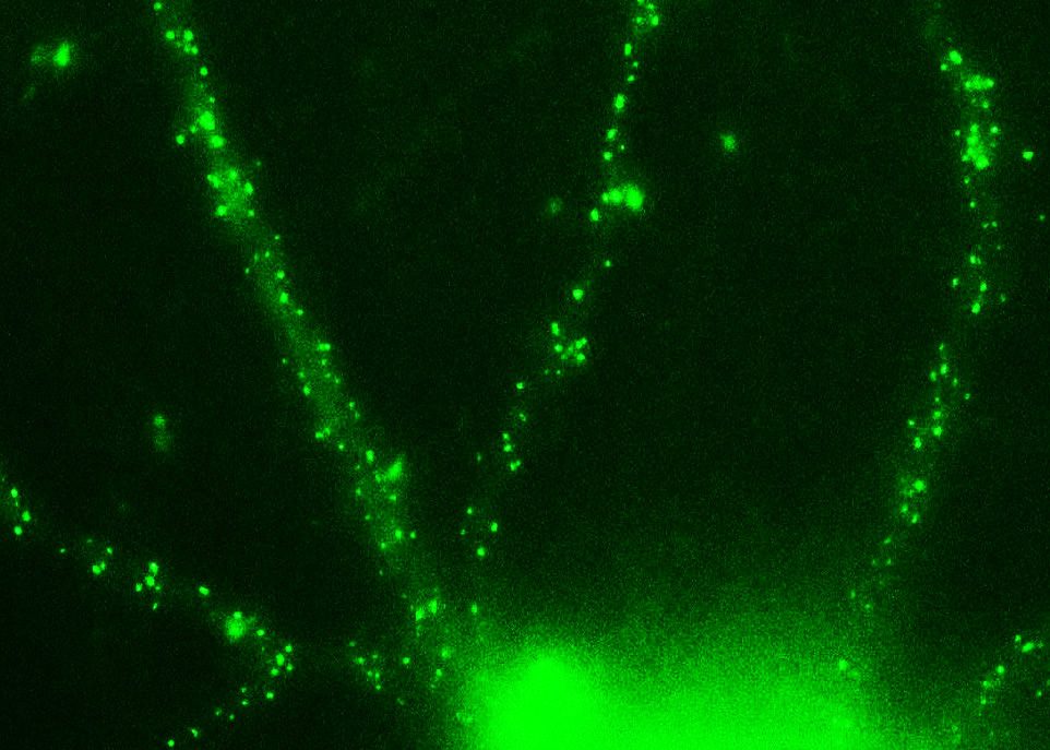 Chirurgie neuronale
