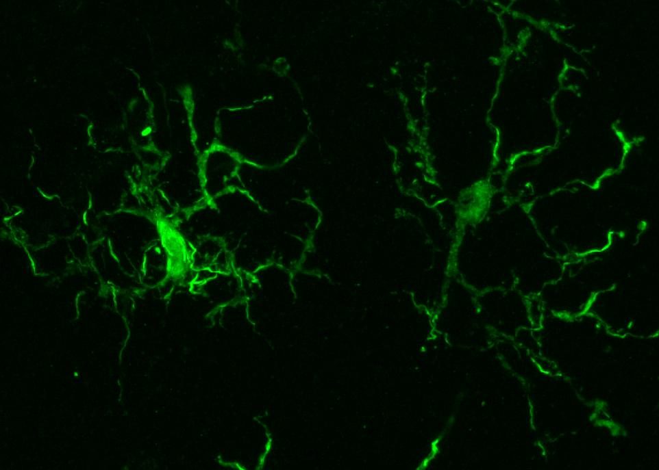 Lumière sur la microglie humaine
