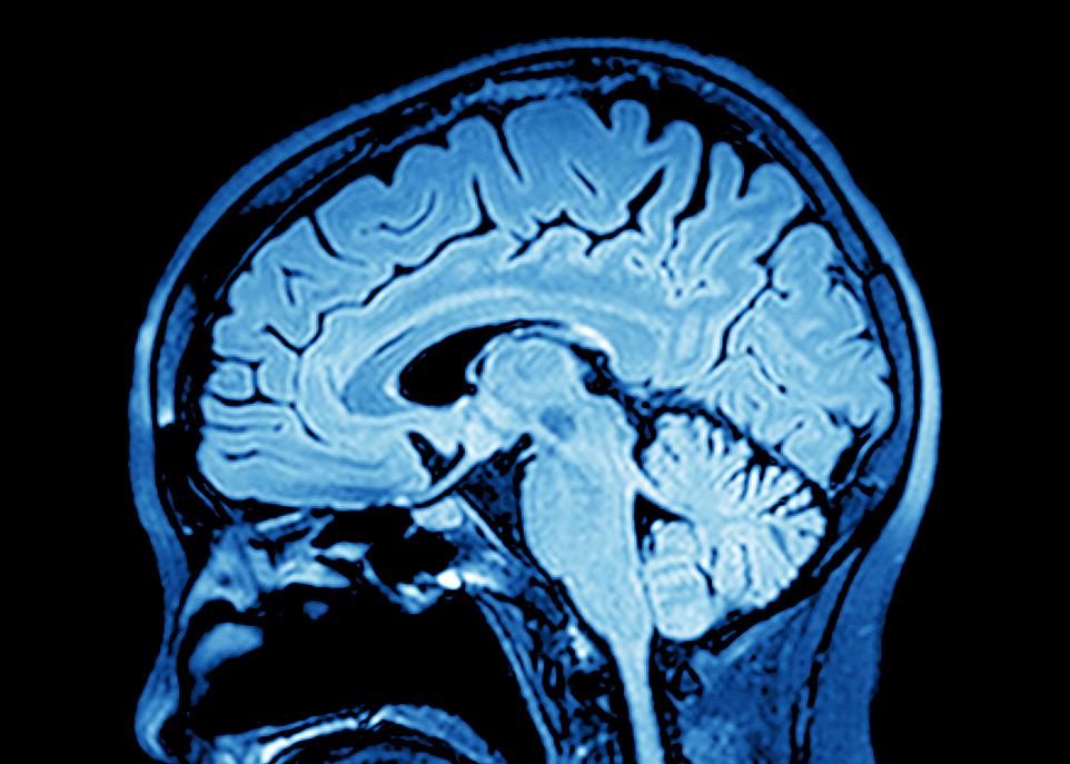 Les fluctuations du zinc lors de la formation du cortex cérébral