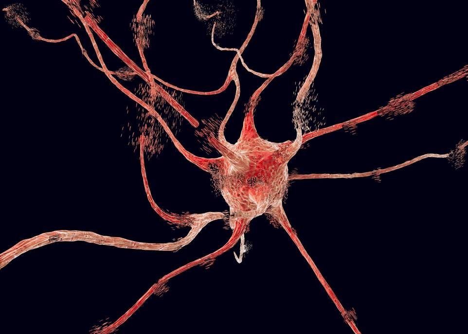 Freiner la maladie de Parkinson ?