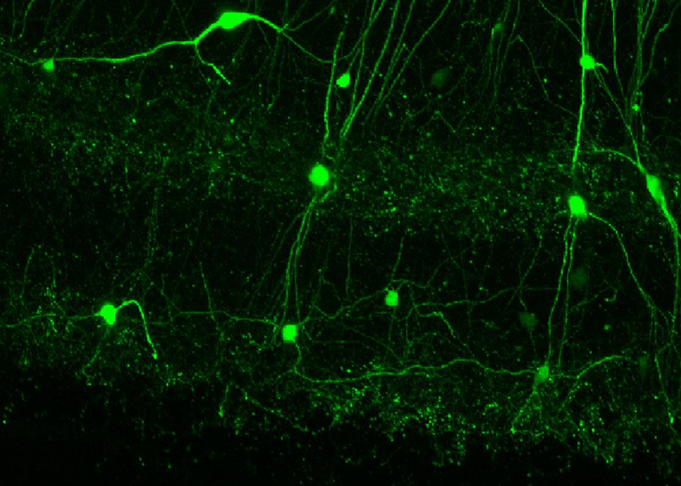 Un nouveau type de neurones découvert