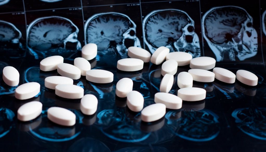 Repositionner des médicaments anti-obésité pour traiter la maladie d'Alzheimer