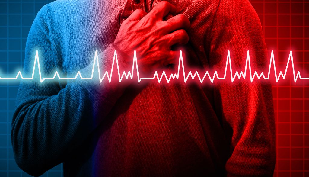 Du froid pour traiter la forme la plus courante d'arythmie