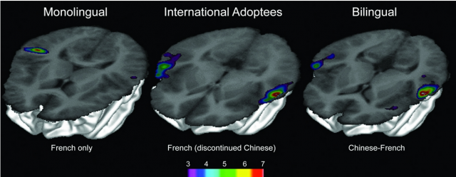 Observer des langues "perdues" dans le cerveau