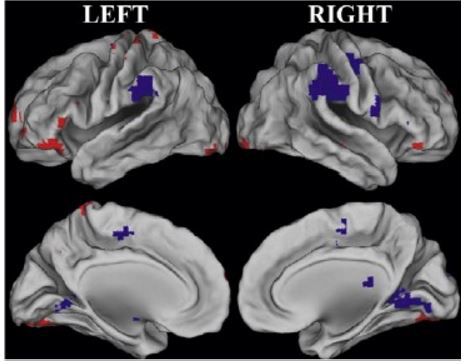 Nouvelles données sur le vieillissement normal du cerveau