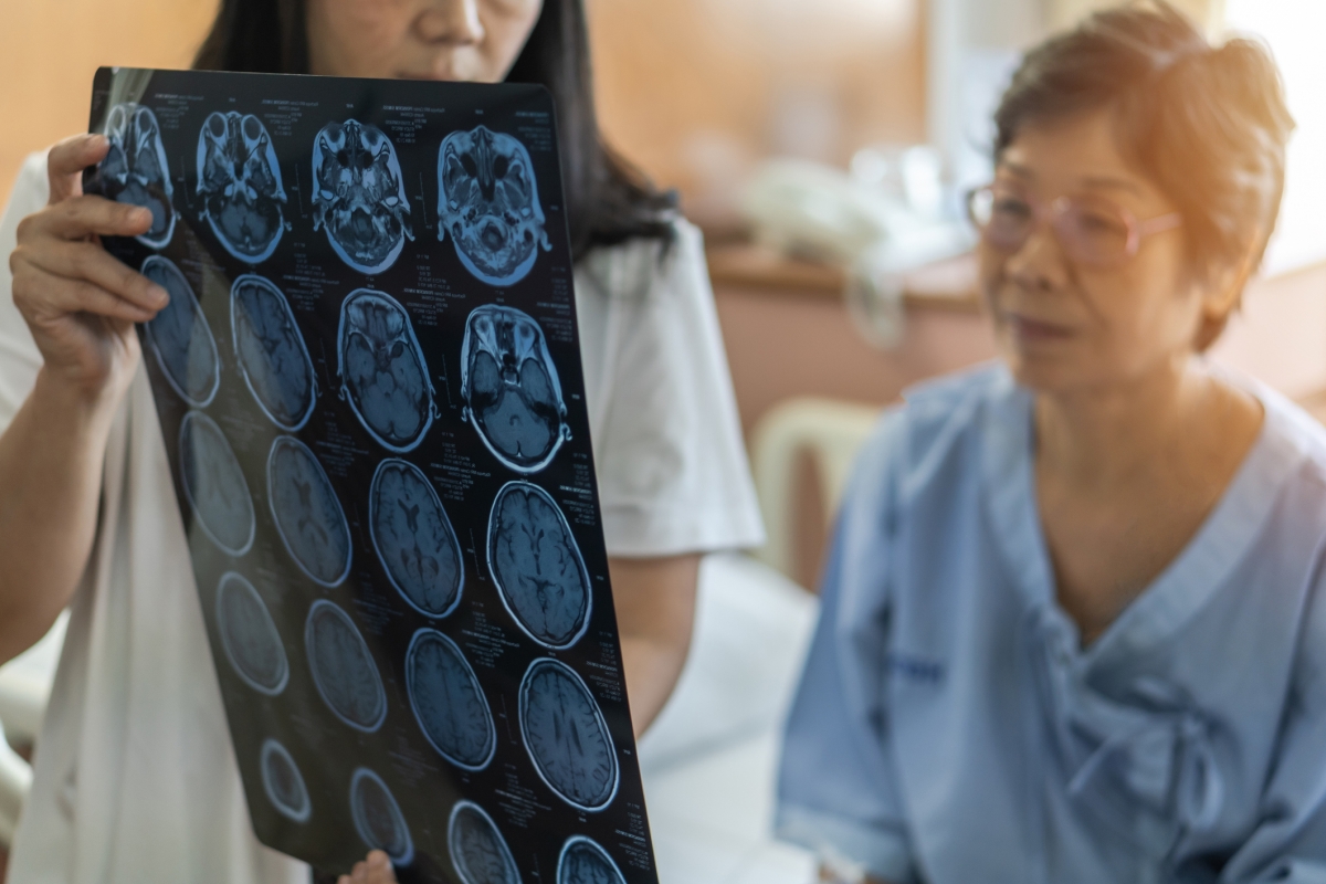 Le ciblage génétique pour vaincre la résistance au traitement du cancer par le cerveau