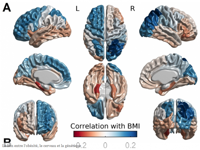 Le lien entre l’obésité, le cerveau et la génétique