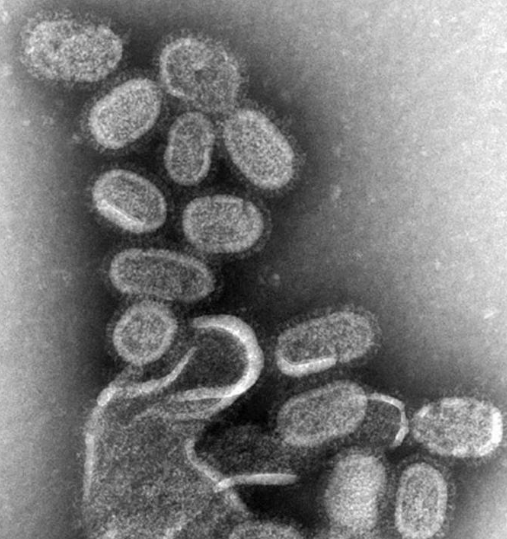 Grippe: une nouvelle approche anti-virale ?